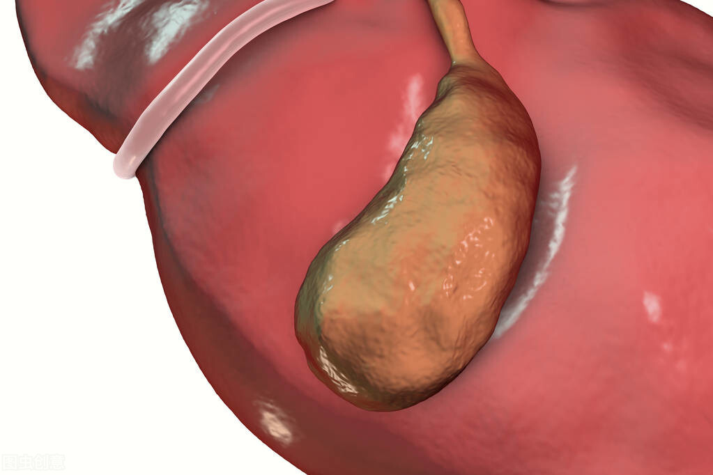 胆囊炎能自己恢复吗？注意这5点，把胆囊炎发生几率降到最低